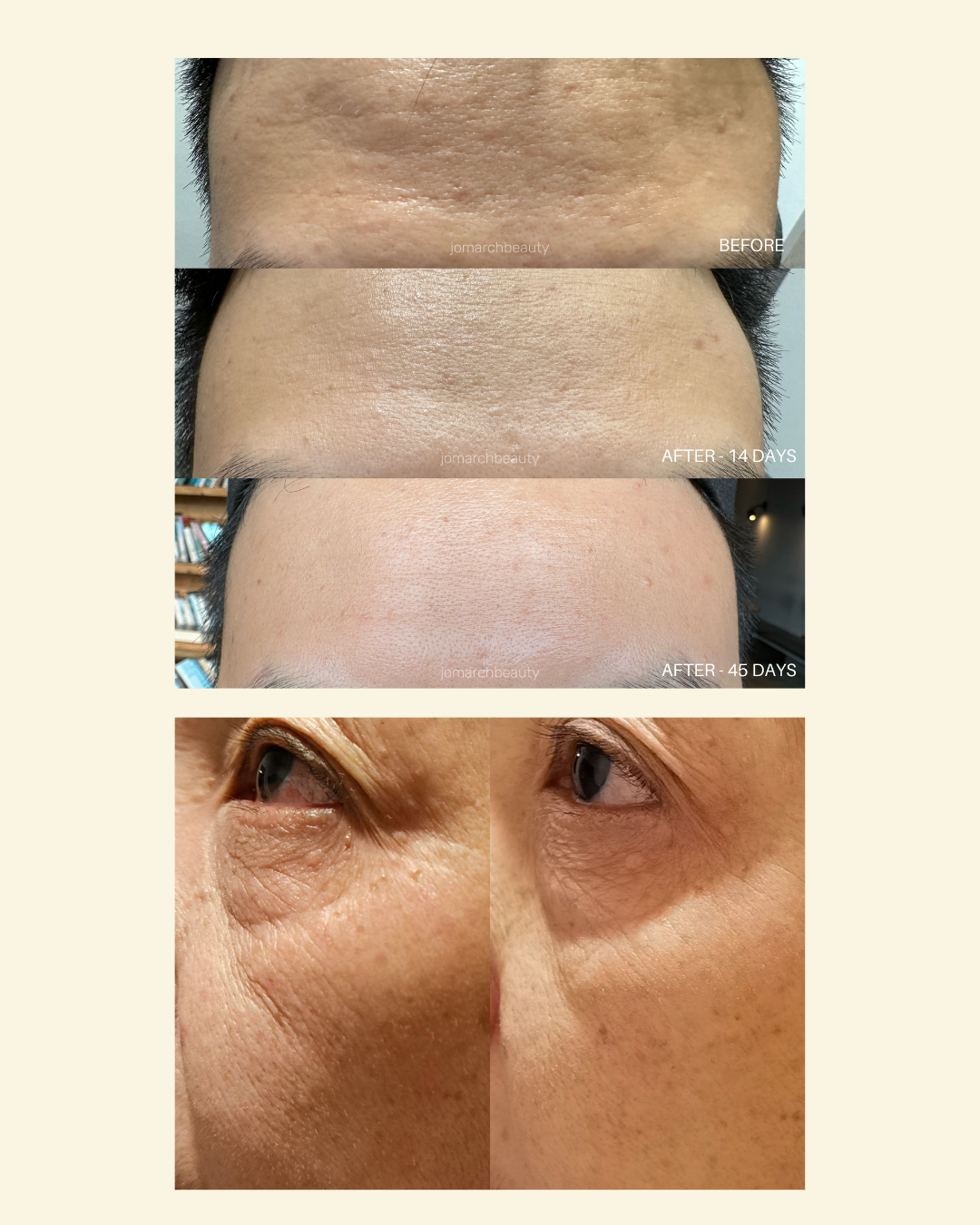 MULTI-PEPTIDE BRILLIANCE SERUM